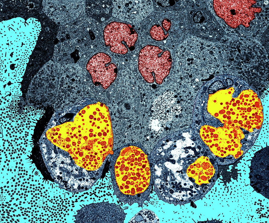 Хламидия 5. Хламидии под электронным микроскопом. Хламидии под микроскопом.