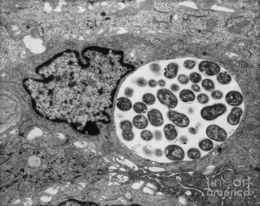 Chlamydia Infection, Tem Photograph by David M. Phillips