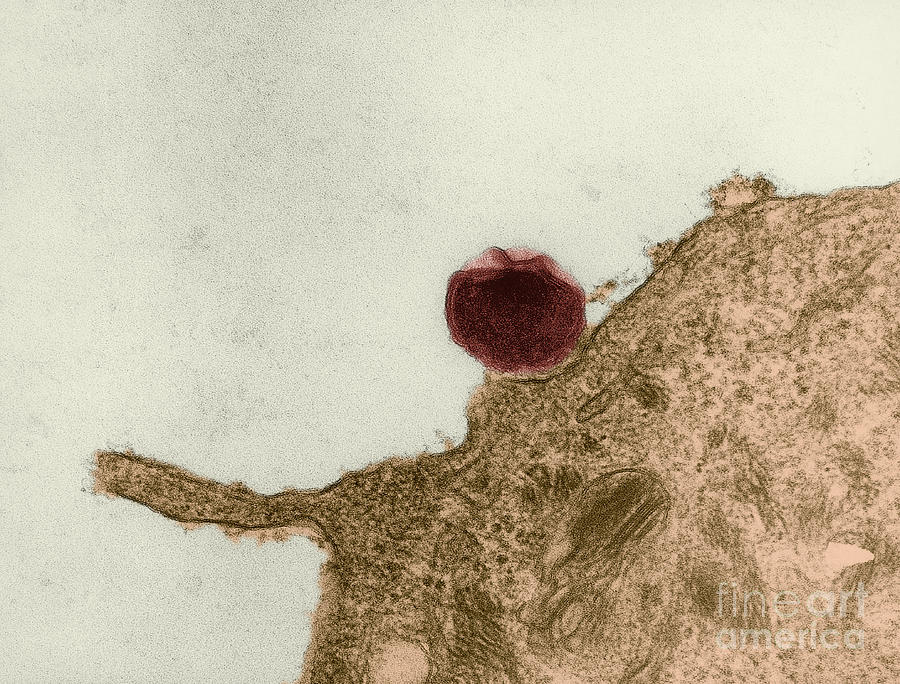 Chlamydia On Oviduct Surface, Tem Photograph by David M. Phillips