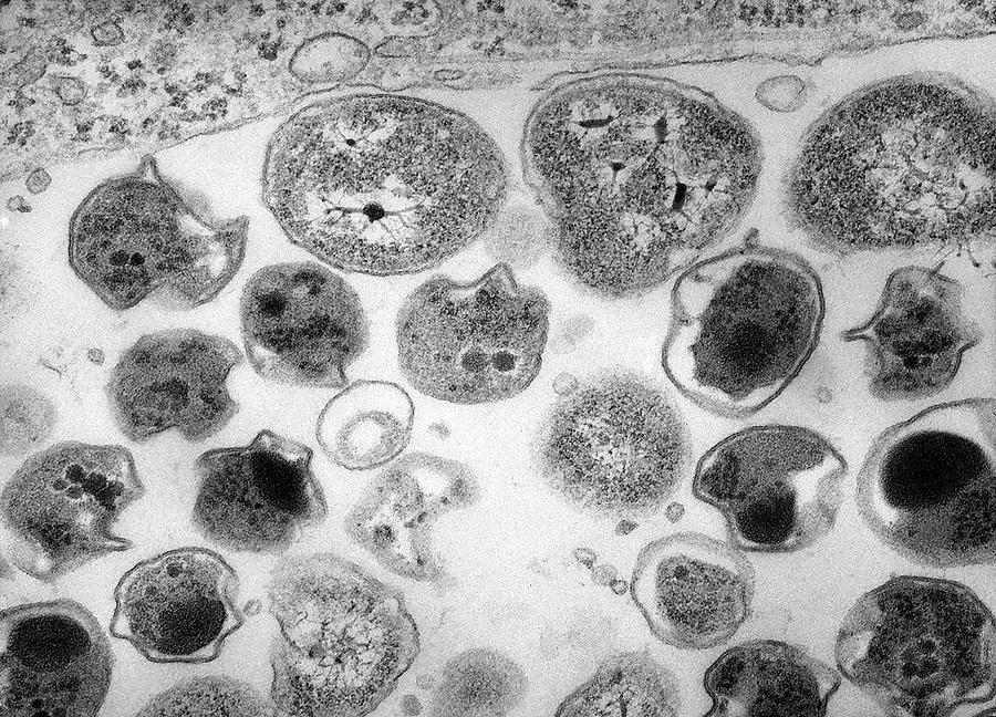 Chlamydia Trachomatis Photograph - Chlamydia Trachomatis Bacteria by Dr Kari Lounatmaa/science Photo Library