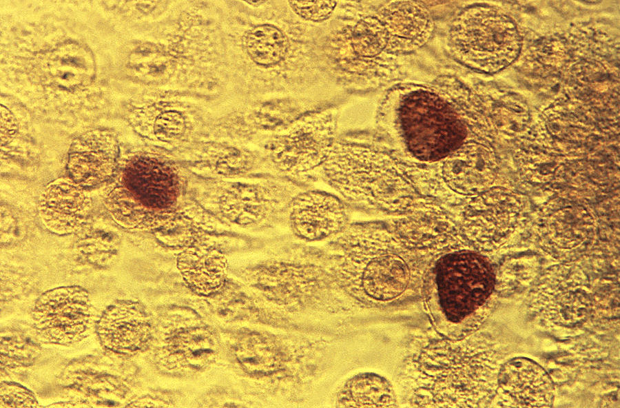 Chlamydia Trachomatis Bacteria, Lm Photograph by Science Source