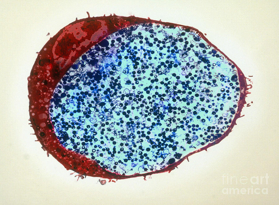 Chlamydia Trachomatis, Tem Photograph by David M. Phillips