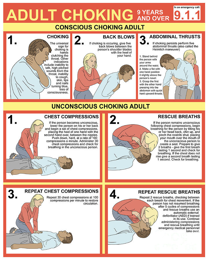 Choking First Aid Chart Photograph by Gwen Shockey