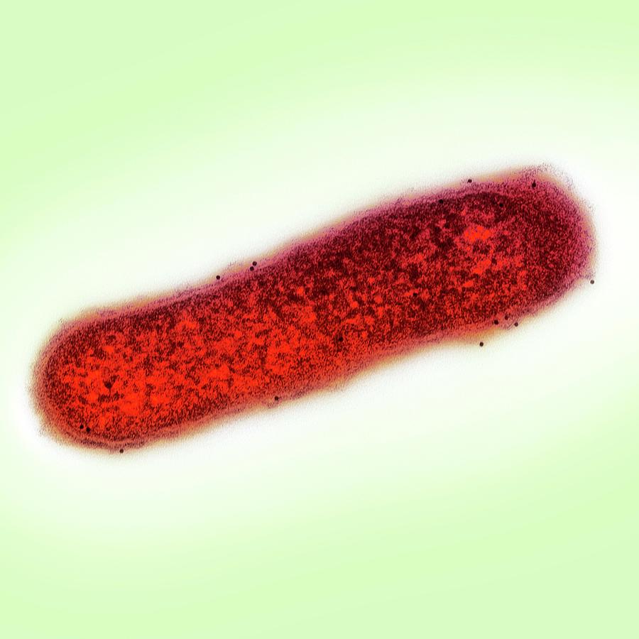 Nature Photograph - Cholera Bacterium by Ami Images