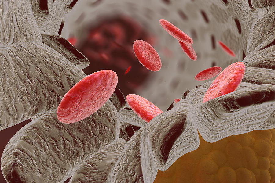 Cholesterol And Red Blood Cells Photograph by Ella Marus Studio