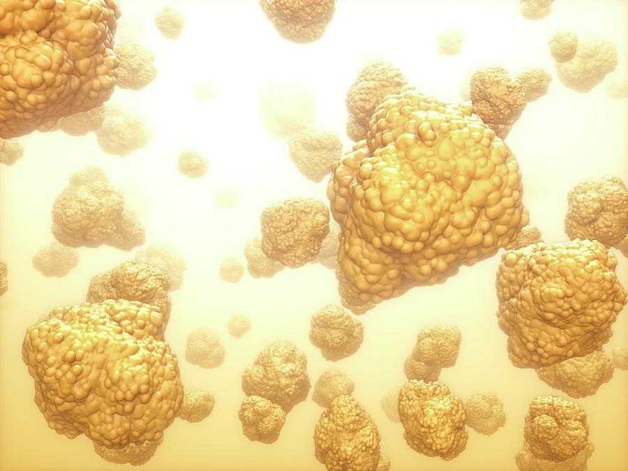 Cholesterol Fat Particles Photograph by Maurizio De Angelis