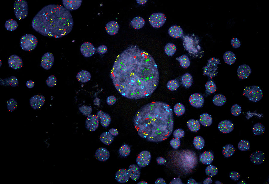 Cell Photograph - Chromosomal Instability In Breast Cancer by Nci Center For Cancer Research/national Cancer Institute/science Photo Library