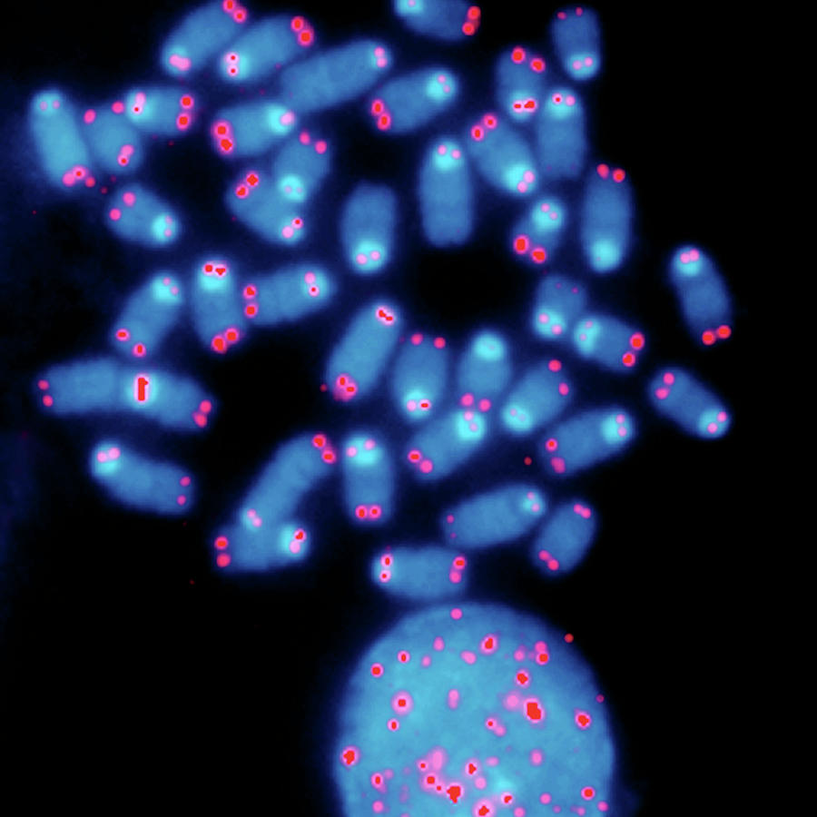 Chromosome Telomeres Photograph by Nci Center For Cancer Research/national Cancer Institute/science Photo Library