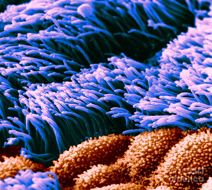 Cilia In Lung, Sem Photograph by David M. Phillips