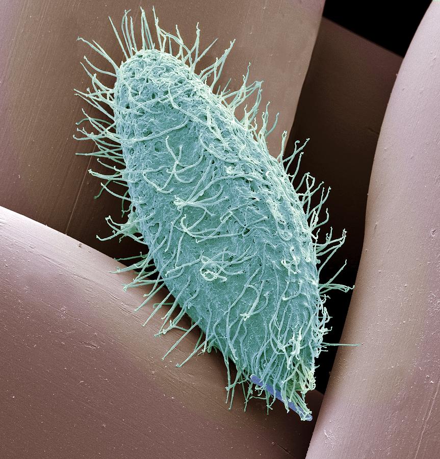 Nature Photograph - Ciliate protozoan, SEM by Science Photo Library