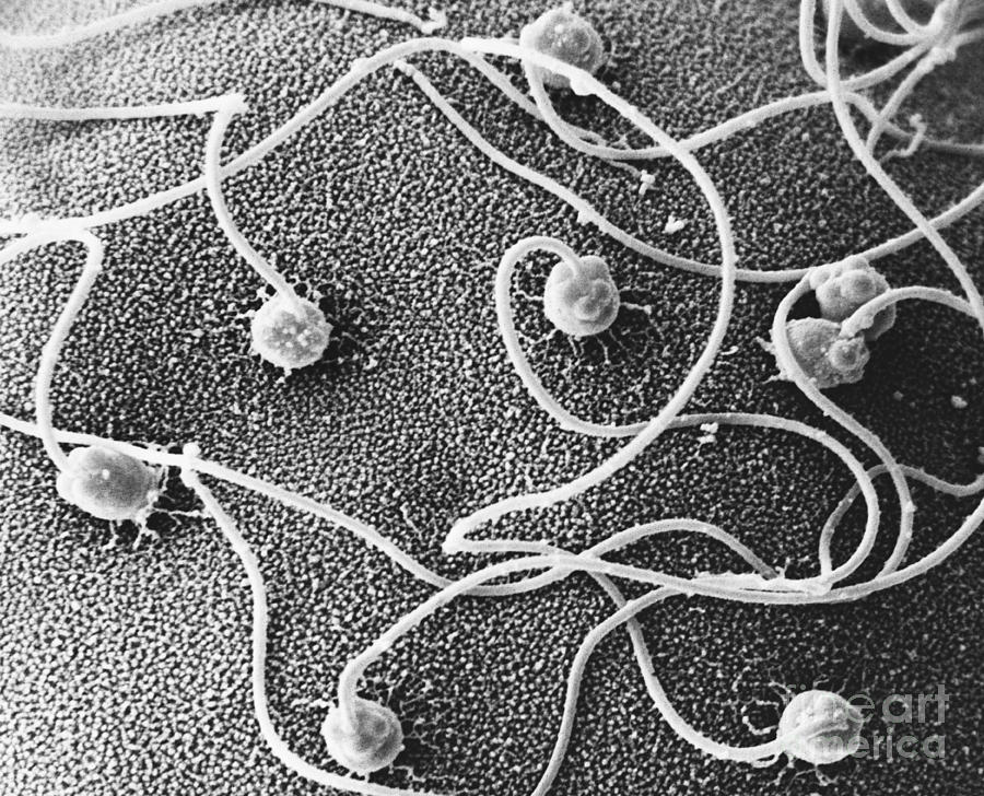 Clam Sperm Fertilizing Egg Sem Photograph by David M. Phillips / The Population Council
