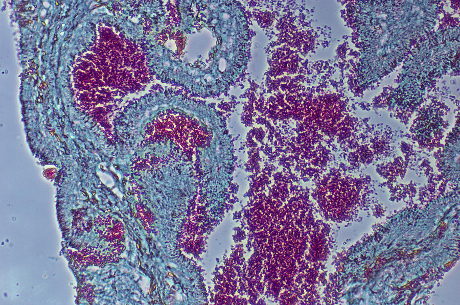 Claviceps Purpurea Photograph by Biology Pics