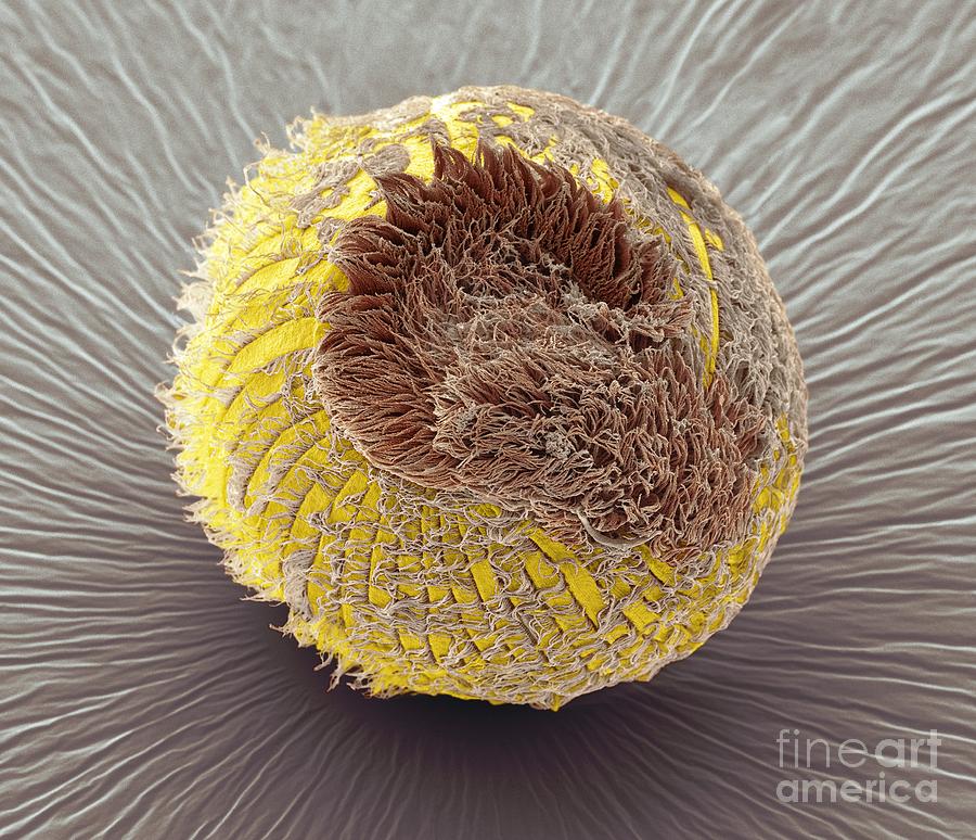 Animal Photograph - Climacostomum Protozoan, Sem by Steve Gschmeissner