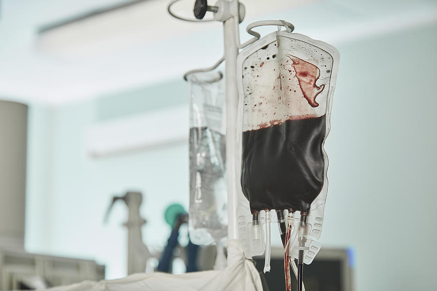 Close-up of blood bag hanging in hospital ward Photograph by Alexandr Sherstobitov