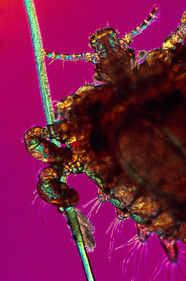 Close up of crab louse on hair Photograph by Michael J. Klein, M.D.