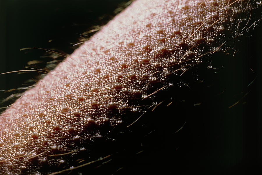 Close-up Of Goose Bumps On Skin Of Forearm Photograph by Martin Dohrn ...