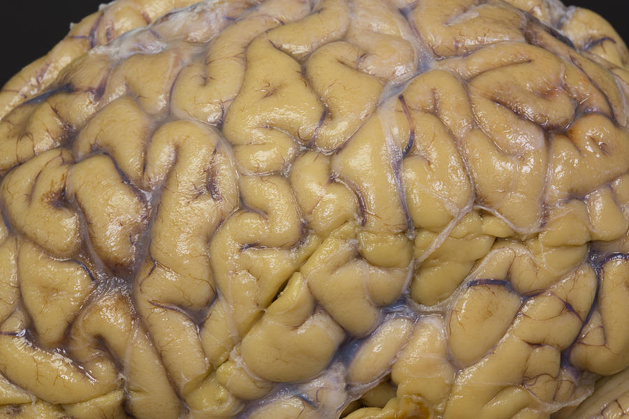 Close-up Of Human Brain Photograph by Science Stock Photography