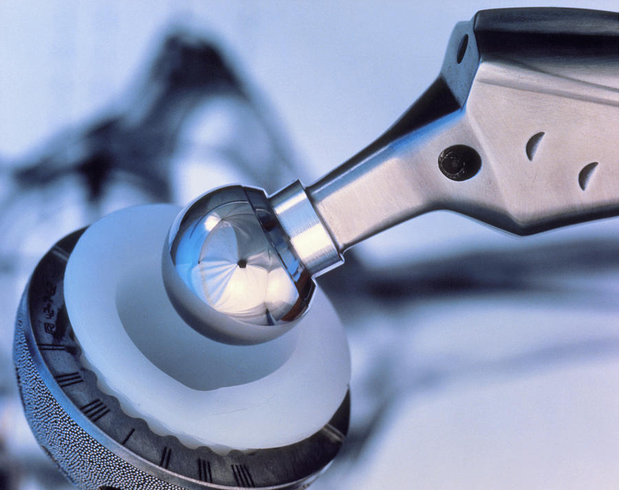 Close-up Of Prosthetic Hip Ball & Socket Photograph by Lawrence ...