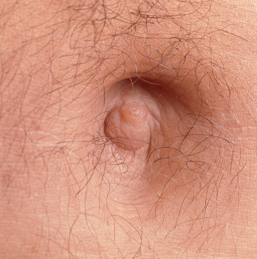 Navel Photograph - Close-up Of The Navel (belly Button) Of A Man by Phil Jude/science Photo Library