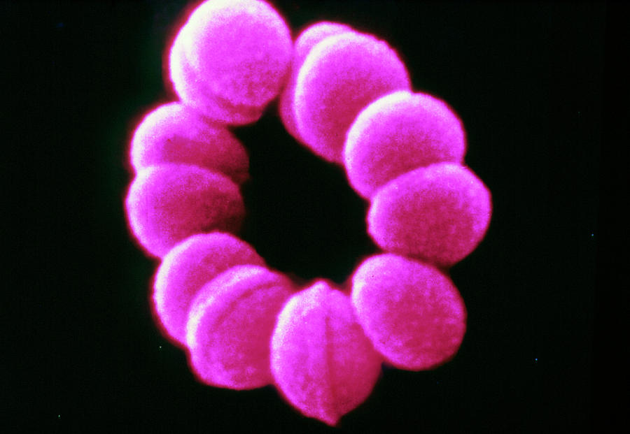 Closed Chain Of Streptococcus Bacteria Photograph by Cnri/science Photo Library