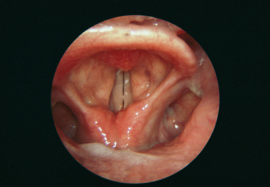 Anatomy Photograph - Closed Larynx by Cnri/science Photo Library
