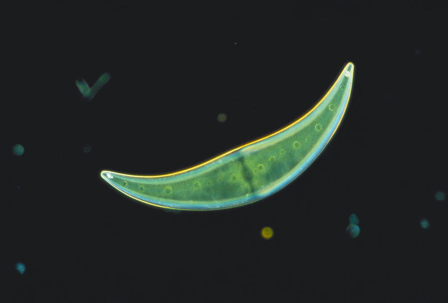Closterium Sp. Algae, Lm Photograph by Perennou Nuridsany