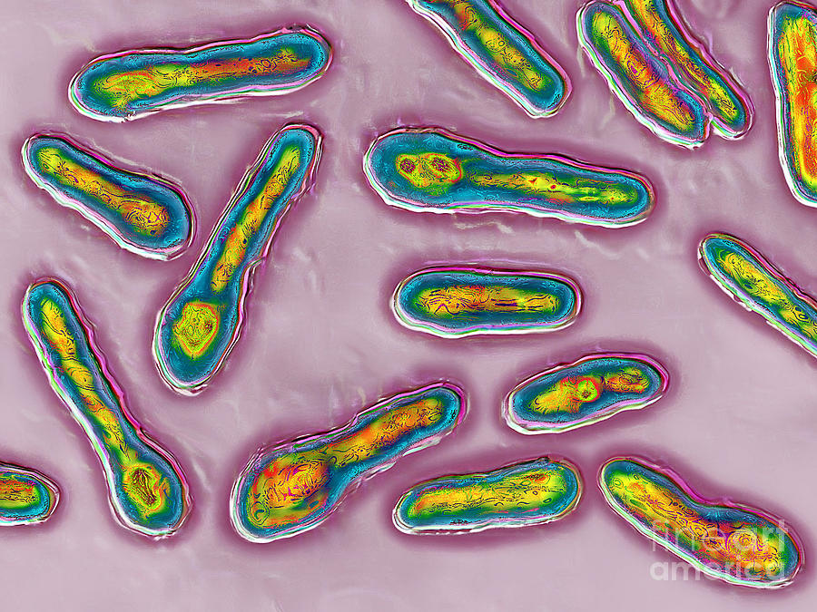 Clostridium Botulinum Bacteria Photograph by James Cavallini