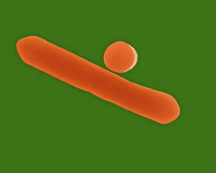 Clostridium Botulinum Photograph by Dennis Kunkel Microscopy/science Photo Library
