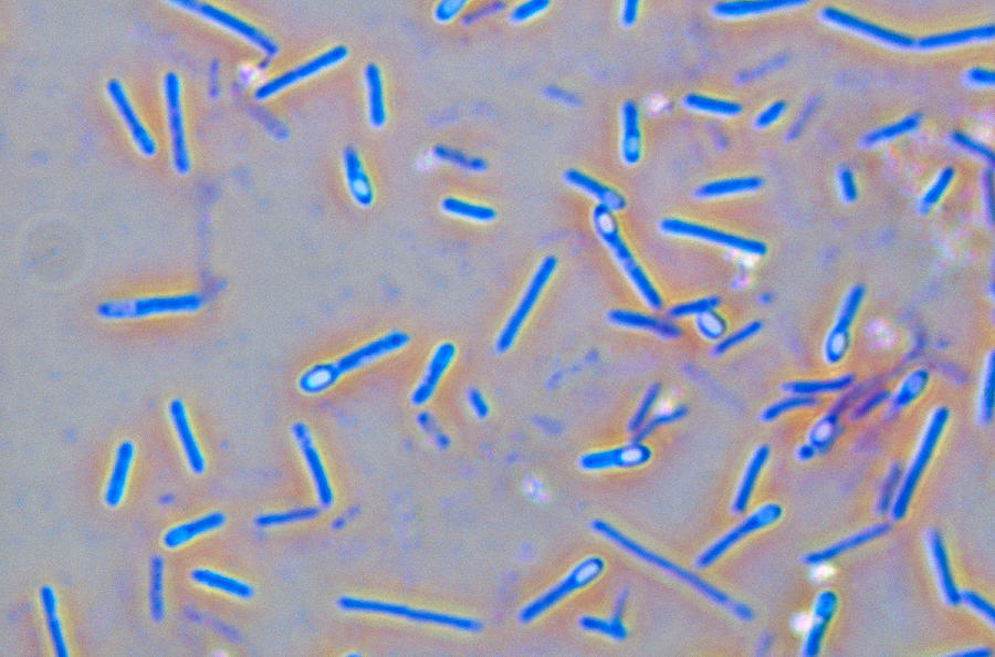 Clostridium Botulinum, Lm Photograph by Michael Abbey