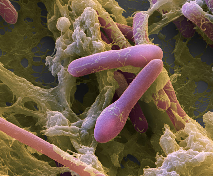 Clostridium Botulinum, Sem Photograph by Eye of Science