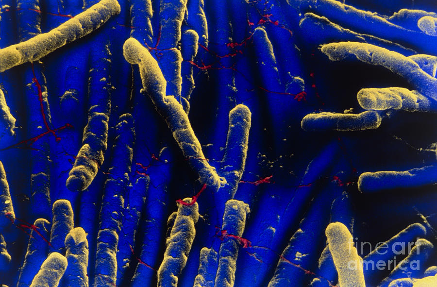 Clostridium Difficile Bacteria Photograph by David Phillips