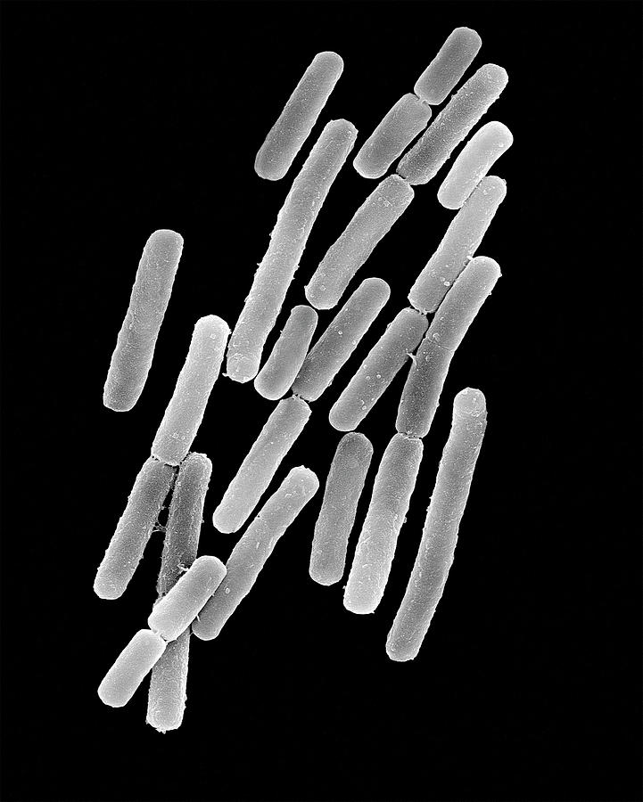 Clostridium Difficile By Dennis Kunkel Microscopy Science Photo Library