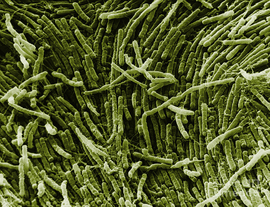 Clostridium, Sem Photograph by David M. Phillips