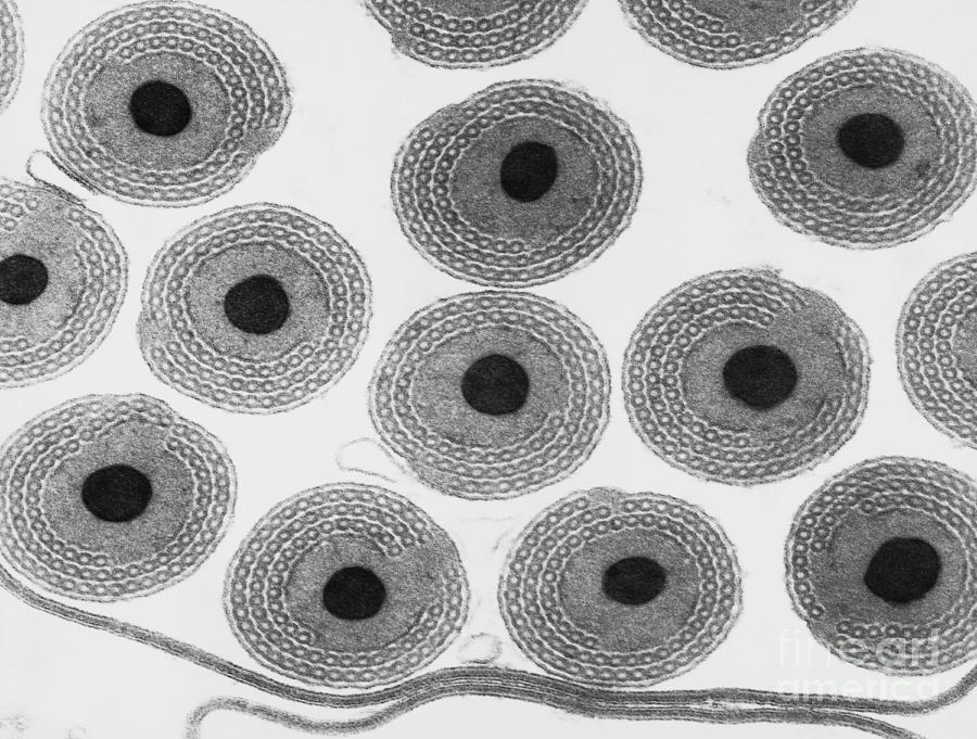 Coccid Insect Sperm Tem Photograph by David M. Phillips