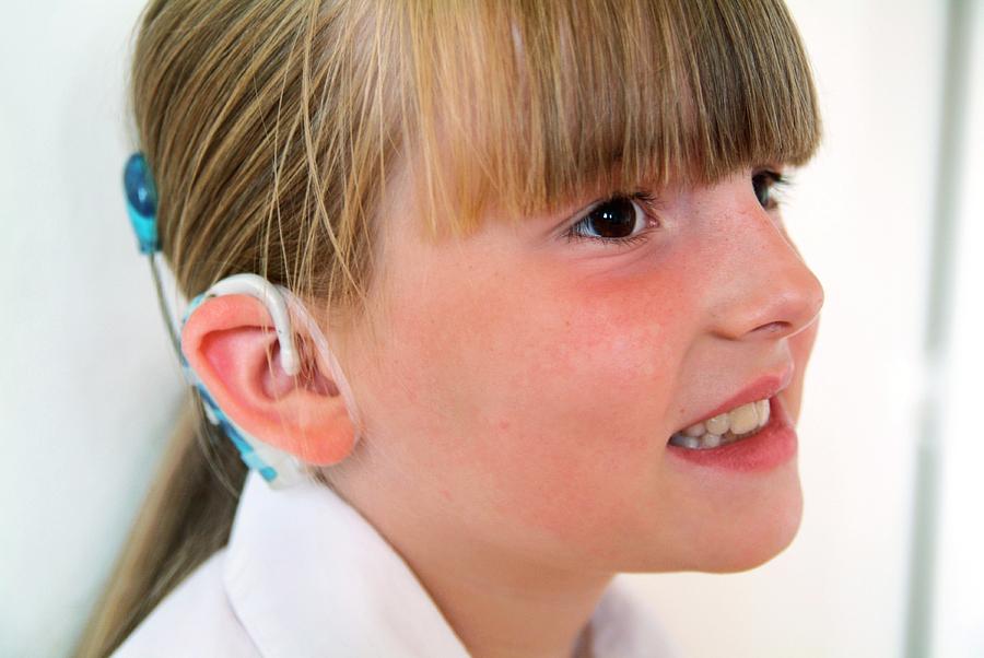 Cochlear Implant Photograph by Hannah Gal/science Photo Library ...