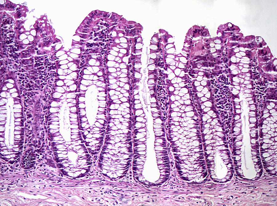 Large Intestine Photograph - Colon Mucosa Lm by Alvin Telser
