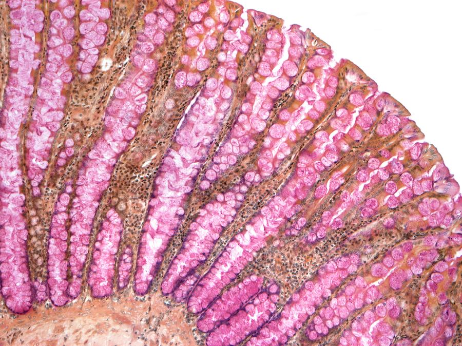 Colon Photograph by Steve Gschmeissner/science Photo Library
