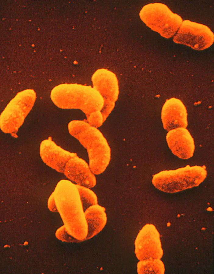 Colony Of Klebsiella Pneumoniae Bacteria Photograph By Dr Tony Brain   Colony Of Klebsiella Pneumoniae Bacteria Dr Tony Brainscience Photo Library 