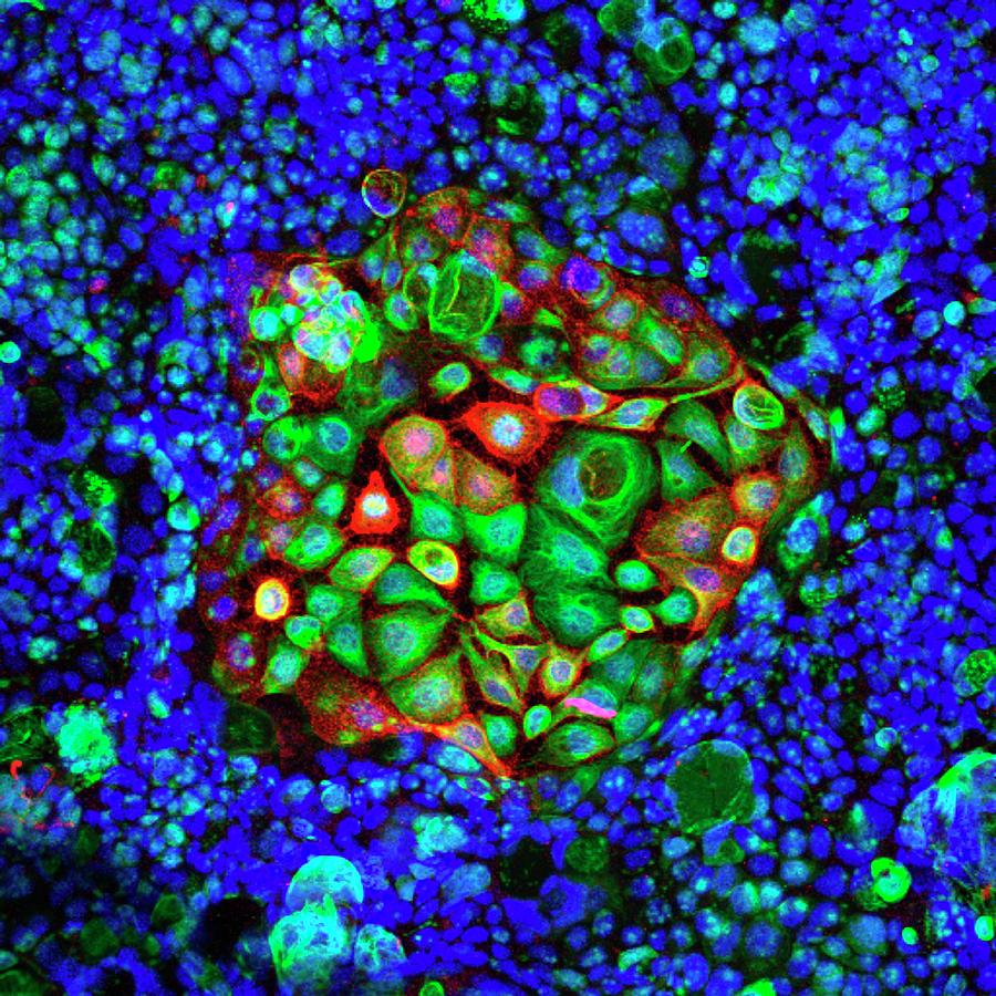 Colorectal Cancer Cells Photograph by Ammrf, University Of Sydney