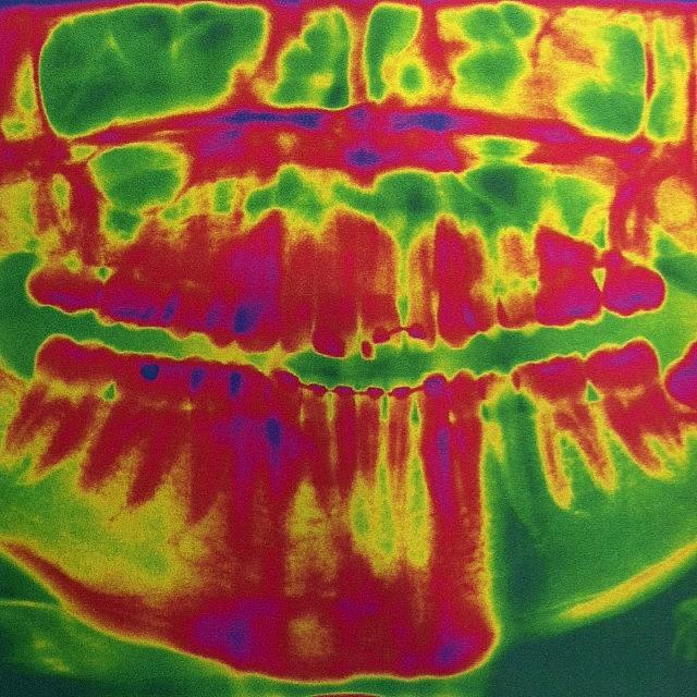Cool Photograph - Colored X-ray If My Teeth #art #color by Ben Gross