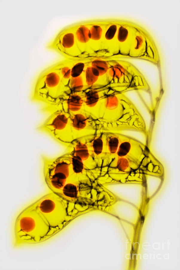 Colorized X-ray Of Seed Pods Photograph by Scott Camazine