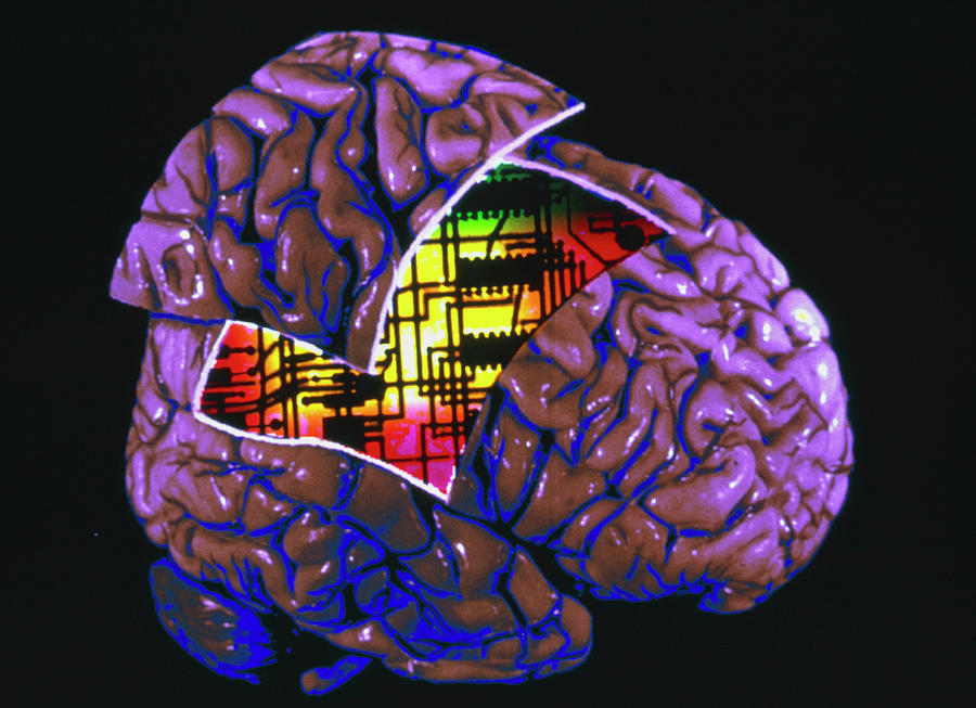 Colour 3-d Mri Brain Scan With Circuit Board In It Photograph by Gjlp/science Photo Library