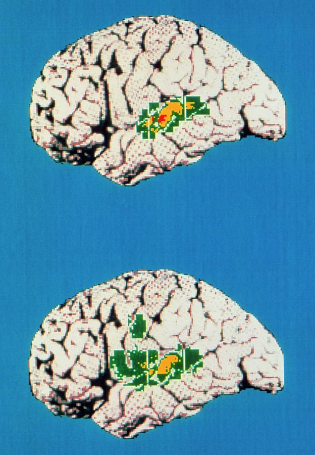 Colour Pet Brain Scan When Listening/repeat Words Photograph by Wellcome Dept. Of Cognitive Neurology/ Science Photo Library