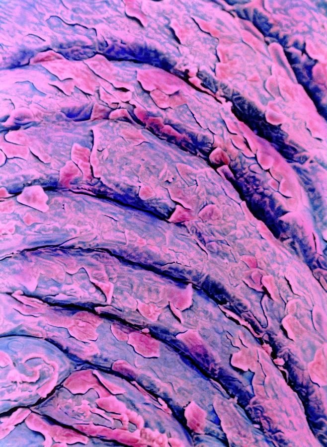 Colour Sem Of Cells Shedding On Vaginal Epithelium Photograph by Steve Gschmeissner/science Photo Library