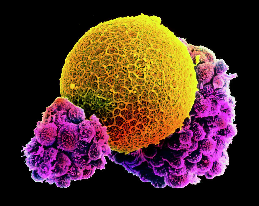 Colour Sem Of Human Egg With Corona Radiata Cells Photograph by Dr Yorgos Nikas/science Photo Library