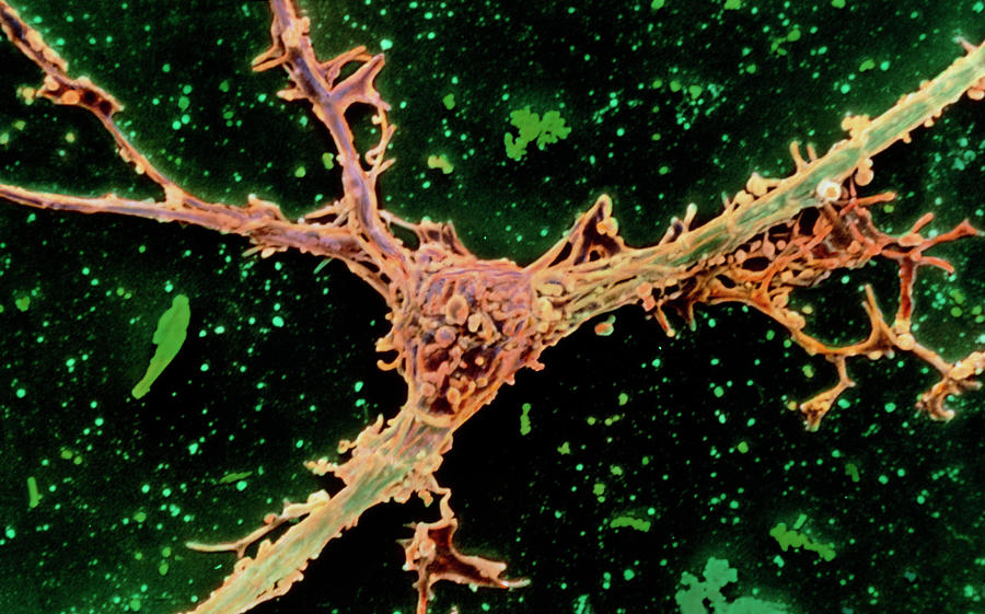 Colour Sem Of Oligodendrocyte Attached To A Nerve Photograph by Dr John Zajicek/science Photo Library