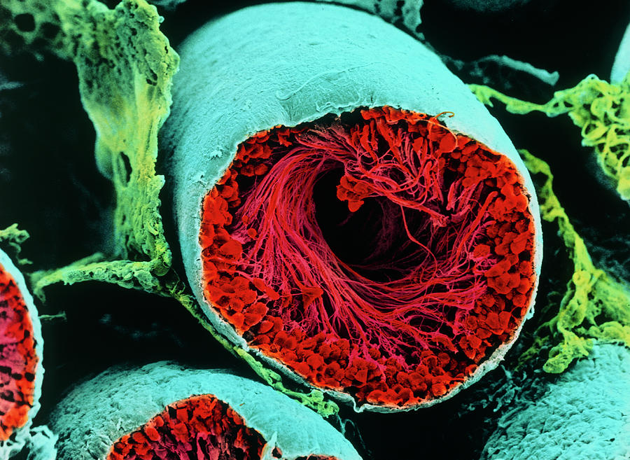 Colour Sem Of Seminiferous Tubule Of The Testis Photograph by Cnri/science Photo Library