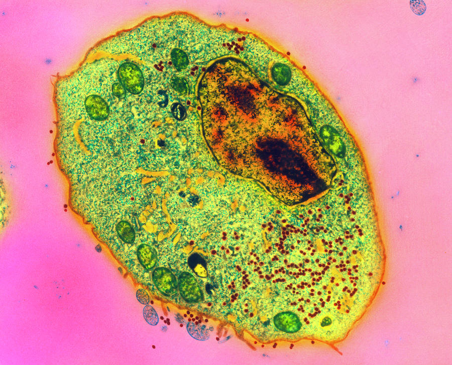 Colour Tem Of Retroviruses Infecting A Cancer Cell Photograph by Vla ...