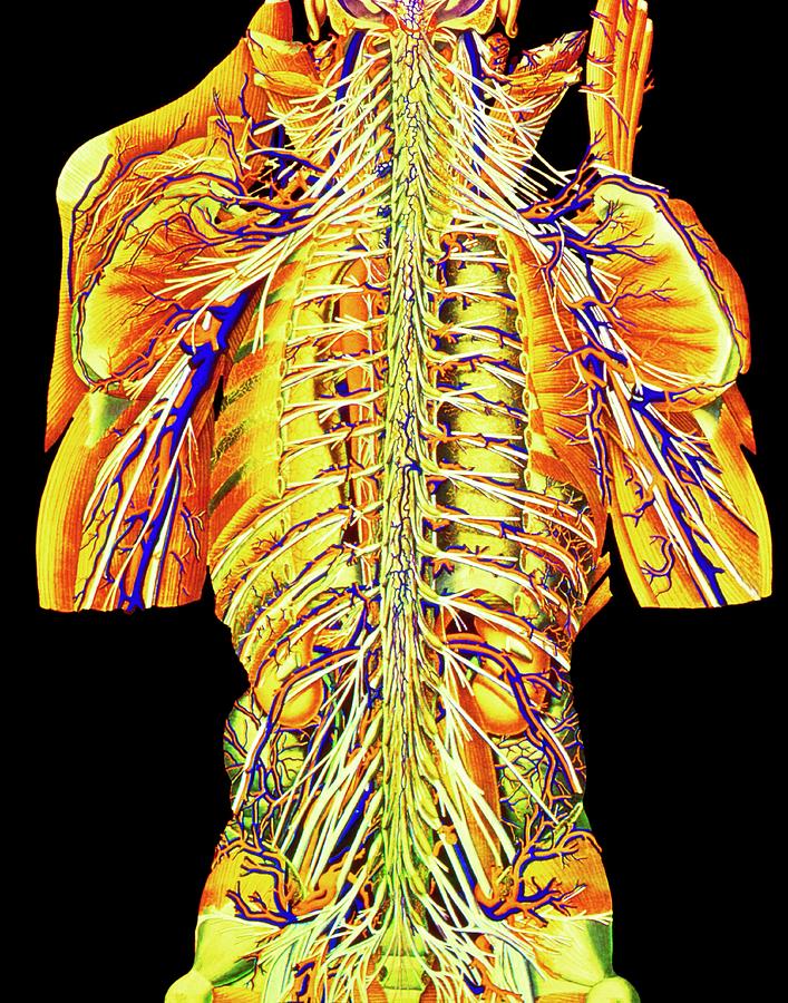 Coloured Artwork Of Spinal Column & Spinal Nerves Photograph by Mehau Kulyk/science Photo Library