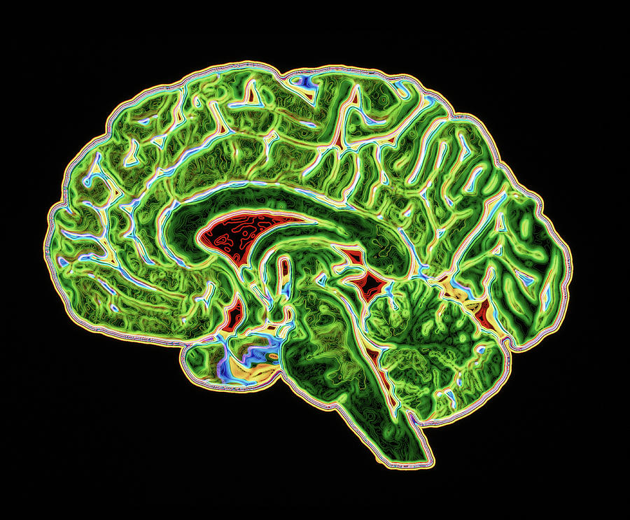 Coloured Ct Scan Of A Healthy Brain (side View) Photograph by Pasieka